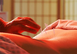 Omaha Chiropractor and Acupuncture
